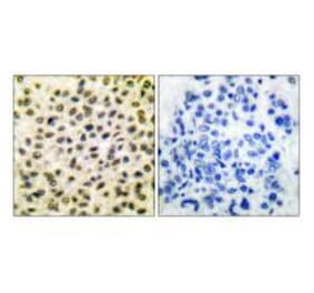 Immunohistochemistry - Fos Antibody from Signalway Antibody (33336) - Antibodies.com