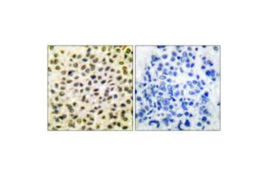Immunohistochemistry - Fos Antibody from Signalway Antibody (33336) - Antibodies.com