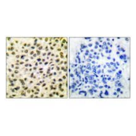 Immunohistochemistry - Fos Antibody from Signalway Antibody (33336) - Antibodies.com