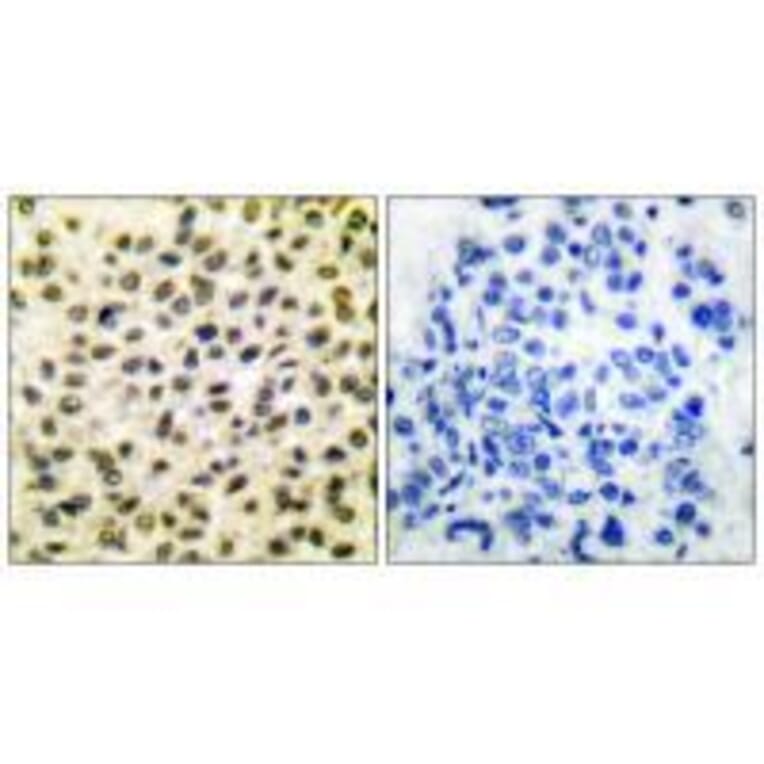 Immunohistochemistry - Fos Antibody from Signalway Antibody (33336) - Antibodies.com