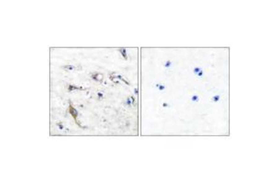 Immunohistochemistry - JM4 Antibody from Signalway Antibody (33412) - Antibodies.com