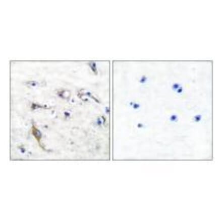Immunohistochemistry - JM4 Antibody from Signalway Antibody (33412) - Antibodies.com