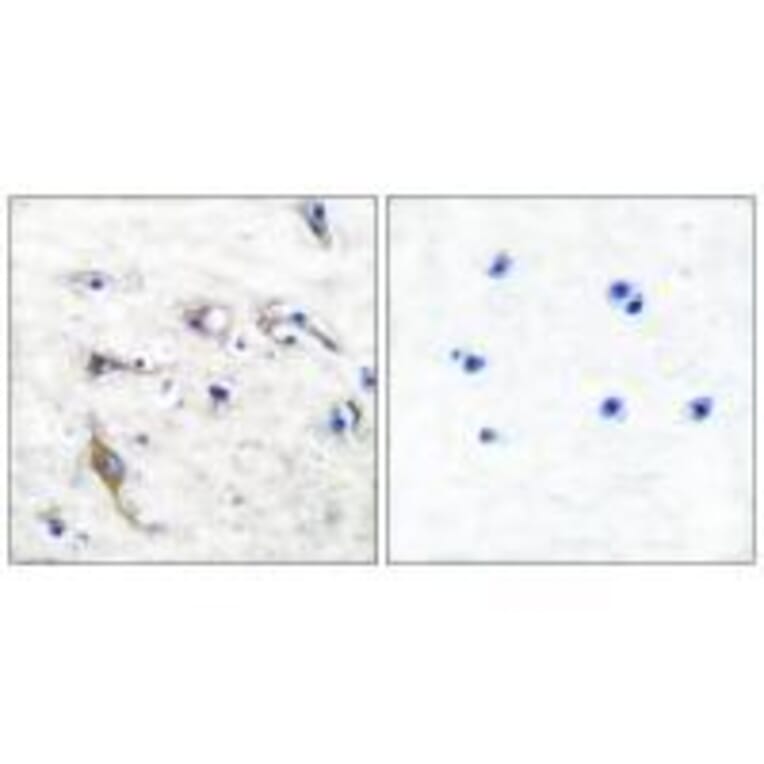 Immunohistochemistry - JM4 Antibody from Signalway Antibody (33412) - Antibodies.com