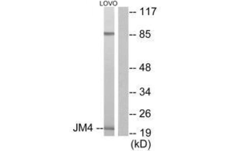 Western blot - JM4 Antibody from Signalway Antibody (33412) - Antibodies.com