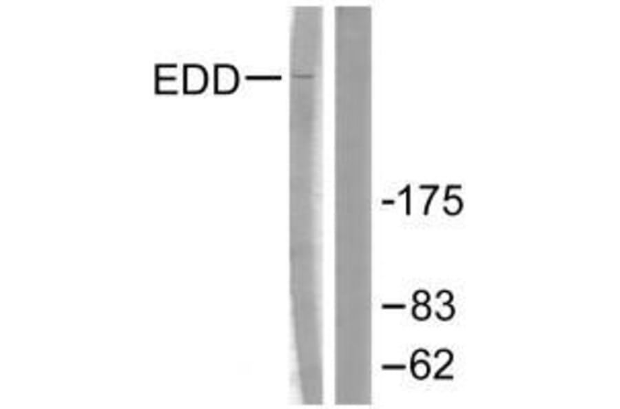 Western blot - EDD Antibody from Signalway Antibody (33509) - Antibodies.com