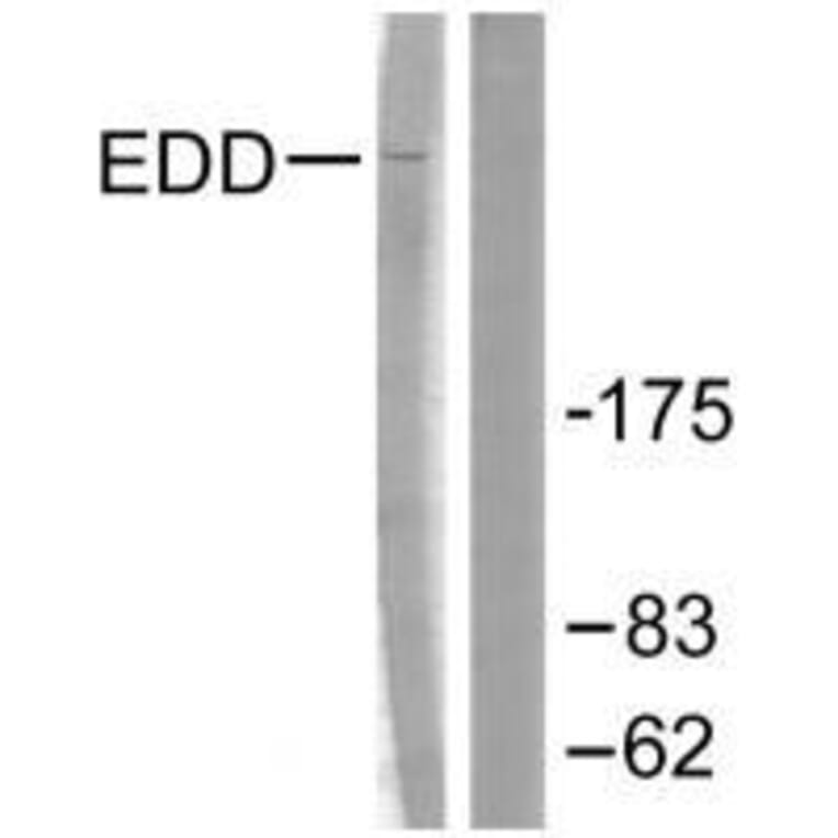 Western blot - EDD Antibody from Signalway Antibody (33509) - Antibodies.com