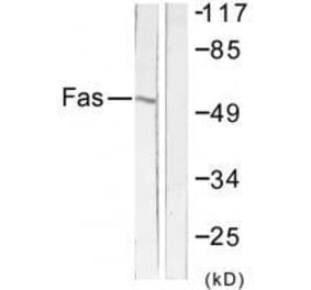 Western blot - FAS Antibody from Signalway Antibody (33510) - Antibodies.com