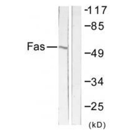 Western blot - FAS Antibody from Signalway Antibody (33510) - Antibodies.com