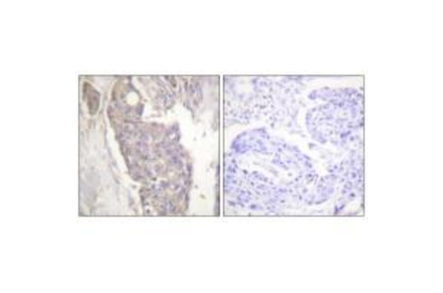 Immunohistochemistry - FAS Antibody from Signalway Antibody (33510) - Antibodies.com