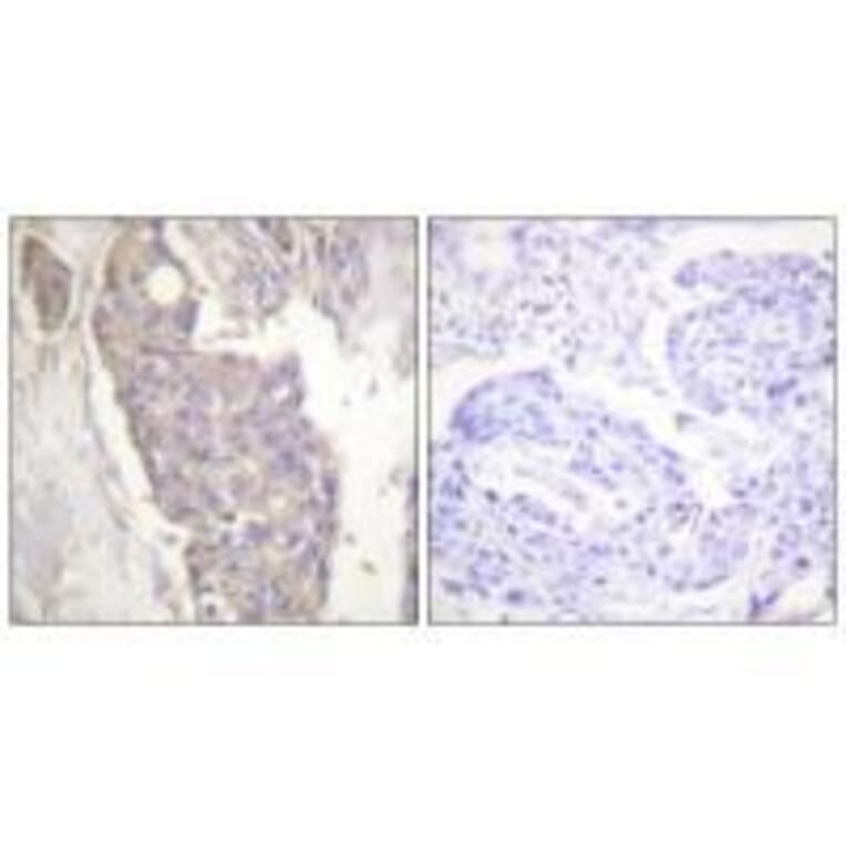 Immunohistochemistry - FAS Antibody from Signalway Antibody (33510) - Antibodies.com