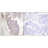 Immunohistochemistry - FAS Antibody from Signalway Antibody (33510) - Antibodies.com