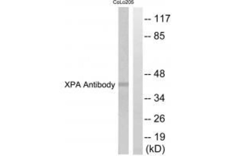 Western blot - XPA Antibody from Signalway Antibody (33544) - Antibodies.com