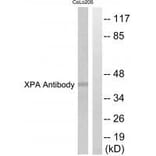 Western blot - XPA Antibody from Signalway Antibody (33544) - Antibodies.com