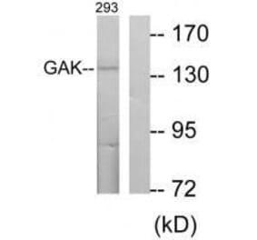 Western blot - GAK Antibody from Signalway Antibody (33573) - Antibodies.com