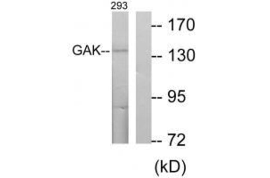 Western blot - GAK Antibody from Signalway Antibody (33573) - Antibodies.com