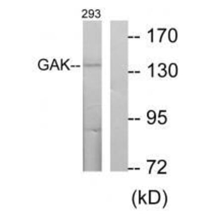 Western blot - GAK Antibody from Signalway Antibody (33573) - Antibodies.com