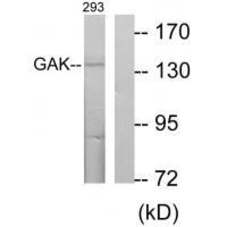 Western blot - GAK Antibody from Signalway Antibody (33573) - Antibodies.com