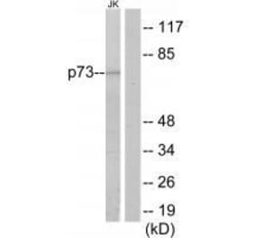 Western blot - p73 Antibody from Signalway Antibody (33579) - Antibodies.com