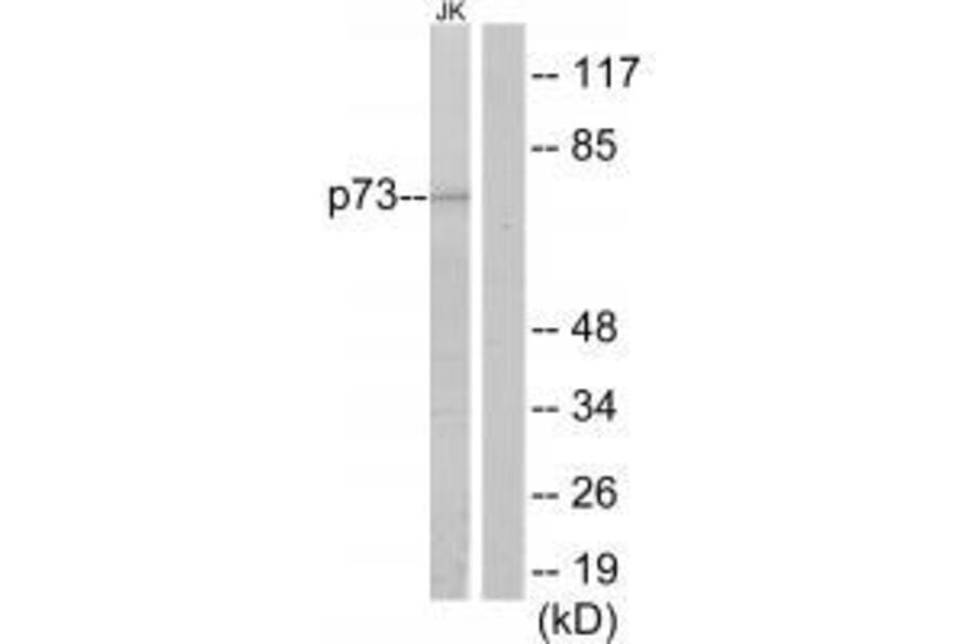 Western blot - p73 Antibody from Signalway Antibody (33579) - Antibodies.com