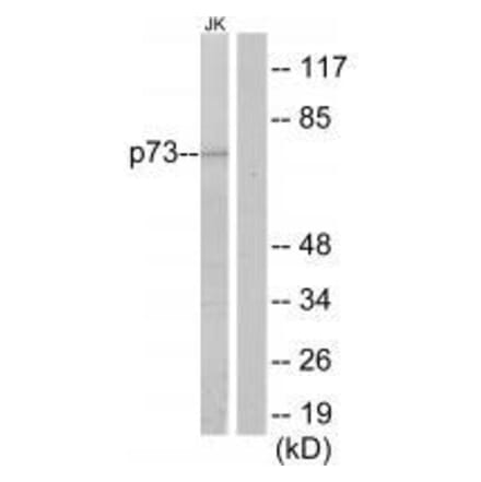 Western blot - p73 Antibody from Signalway Antibody (33579) - Antibodies.com