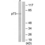 Western blot - p73 Antibody from Signalway Antibody (33579) - Antibodies.com