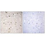 Immunohistochemistry - p73 Antibody from Signalway Antibody (33579) - Antibodies.com