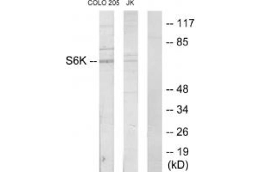 Western blot - S6K Antibody from Signalway Antibody (33720) - Antibodies.com