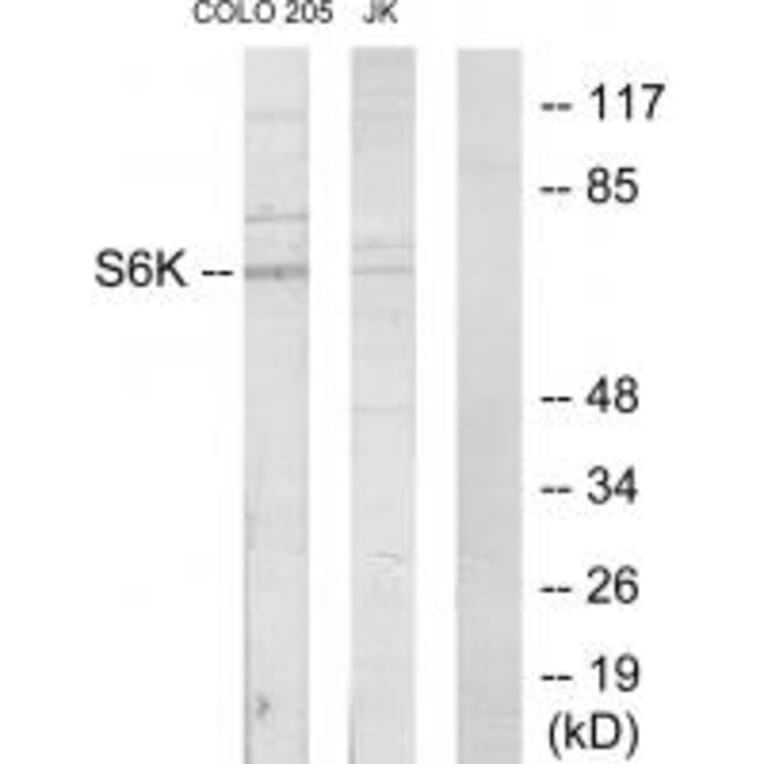 Western blot - S6K Antibody from Signalway Antibody (33720) - Antibodies.com