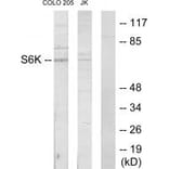 Western blot - S6K Antibody from Signalway Antibody (33720) - Antibodies.com