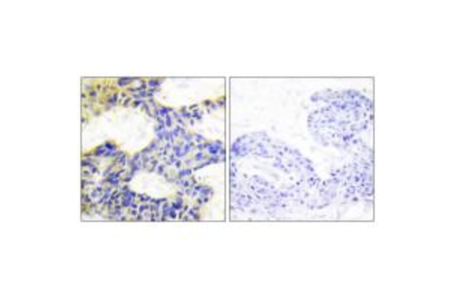 Immunohistochemistry - S6K Antibody from Signalway Antibody (33720) - Antibodies.com