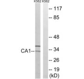 Western blot - CA1 Antibody from Signalway Antibody (34537) - Antibodies.com