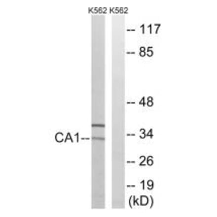 Western blot - CA1 Antibody from Signalway Antibody (34537) - Antibodies.com