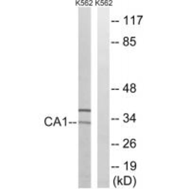 Western blot - CA1 Antibody from Signalway Antibody (34537) - Antibodies.com