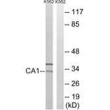 Western blot - CA1 Antibody from Signalway Antibody (34537) - Antibodies.com