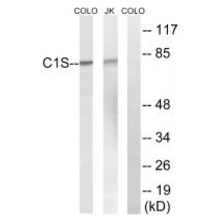 Western blot - C1S Antibody from Signalway Antibody (34610) - Antibodies.com