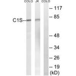 Western blot - C1S Antibody from Signalway Antibody (34610) - Antibodies.com