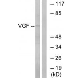 Western blot - VGF Antibody from Signalway Antibody (34863) - Antibodies.com