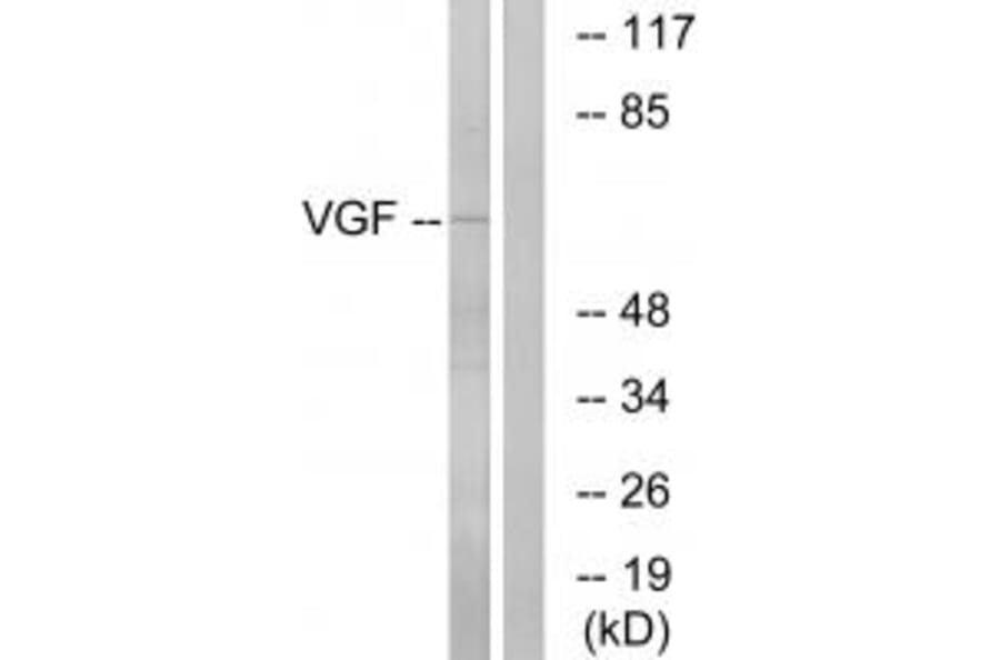 Western blot - VGF Antibody from Signalway Antibody (34863) - Antibodies.com