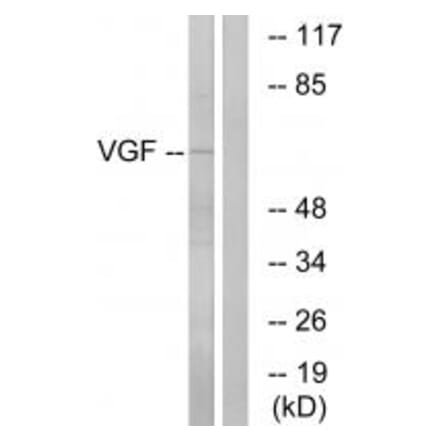 Western blot - VGF Antibody from Signalway Antibody (34863) - Antibodies.com
