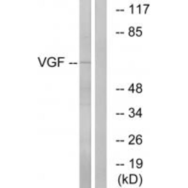 Western blot - VGF Antibody from Signalway Antibody (34863) - Antibodies.com