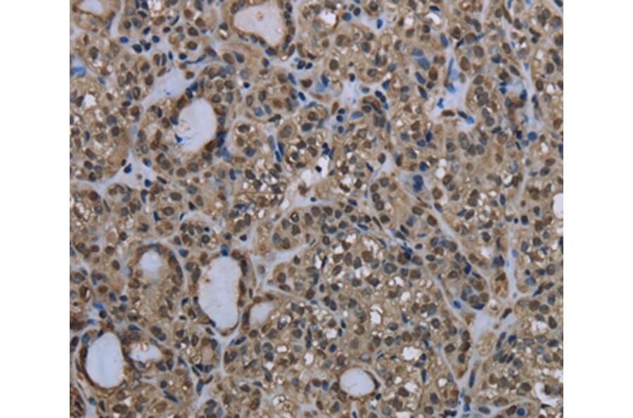 Immunohistochemistry - UBB Antibody from Signalway Antibody (35548) - Antibodies.com