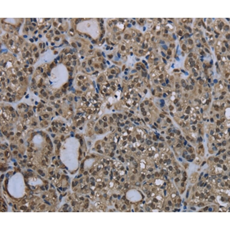 Immunohistochemistry - UBB Antibody from Signalway Antibody (35548) - Antibodies.com