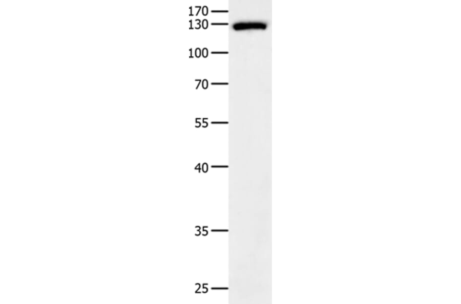 EGF Antibody from Signalway Antibody (35720) - Antibodies.com