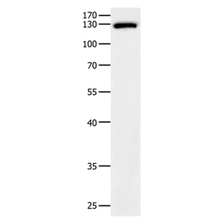 EGF Antibody from Signalway Antibody (35720) - Antibodies.com