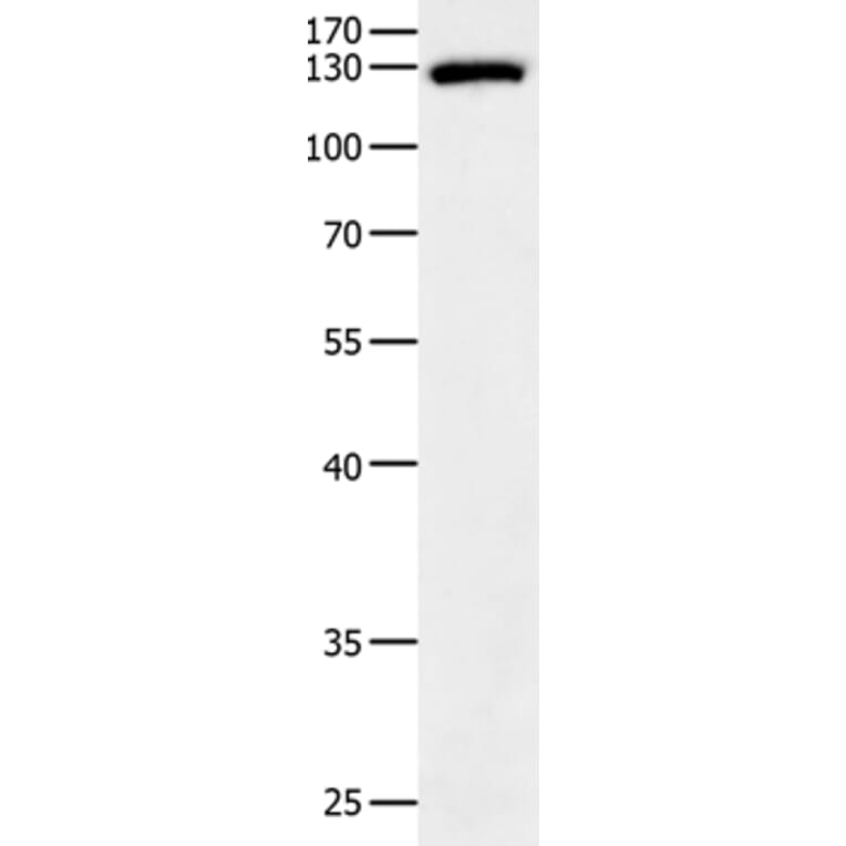 EGF Antibody from Signalway Antibody (35720) - Antibodies.com