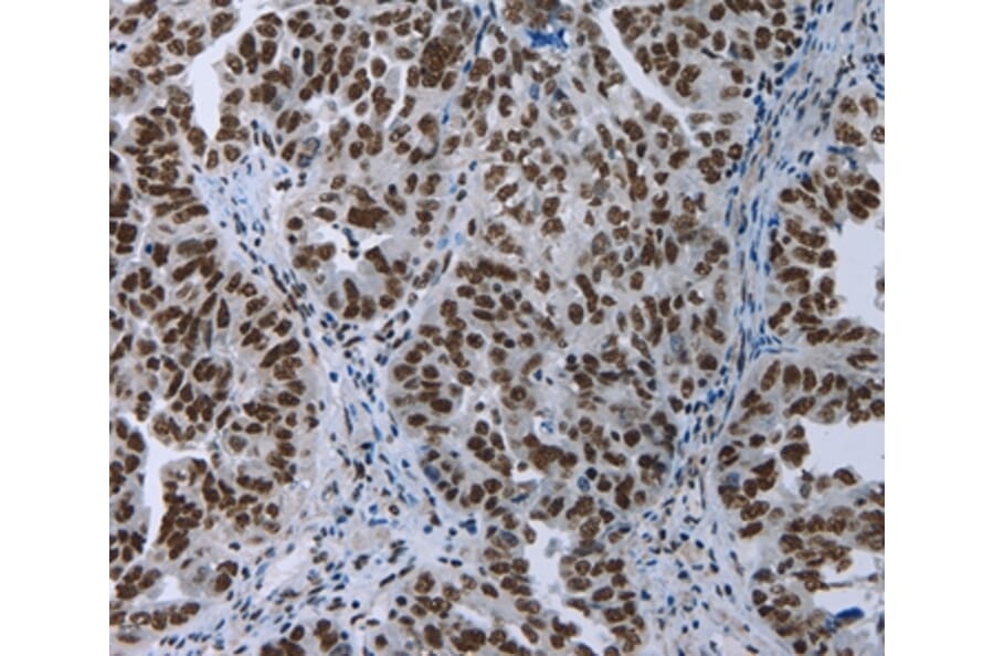 Immunohistochemistry - ELN Antibody from Signalway Antibody (35724) - Antibodies.com