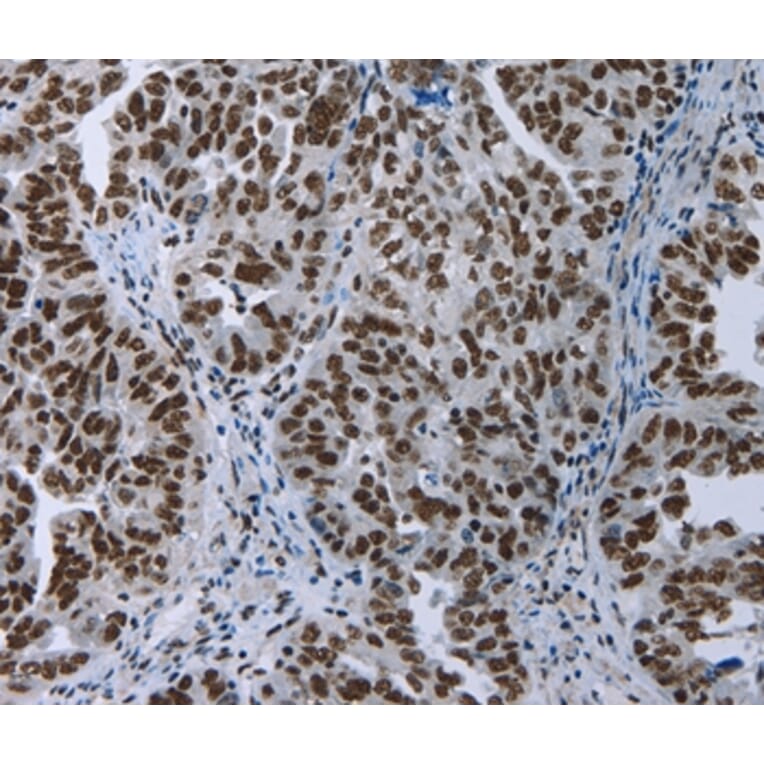 Immunohistochemistry - ELN Antibody from Signalway Antibody (35724) - Antibodies.com