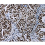 Immunohistochemistry - ELN Antibody from Signalway Antibody (35724) - Antibodies.com