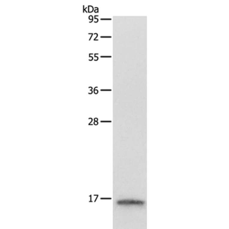 LYZ Antibody from Signalway Antibody (35805) - Antibodies.com