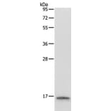LYZ Antibody from Signalway Antibody (35805) - Antibodies.com